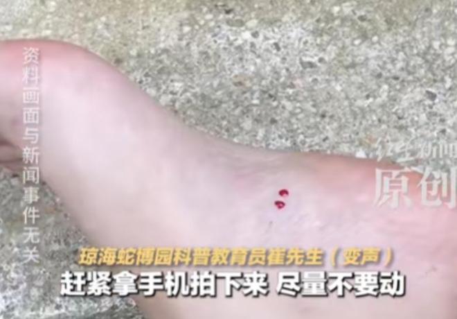 院迷惑操作家属接连发声已成立调查组尊龙凯时APP游客蛇伤致死后续！医(图23)